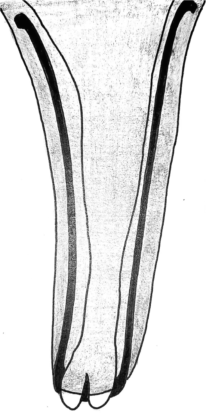 Principles of fracture fixation techniques