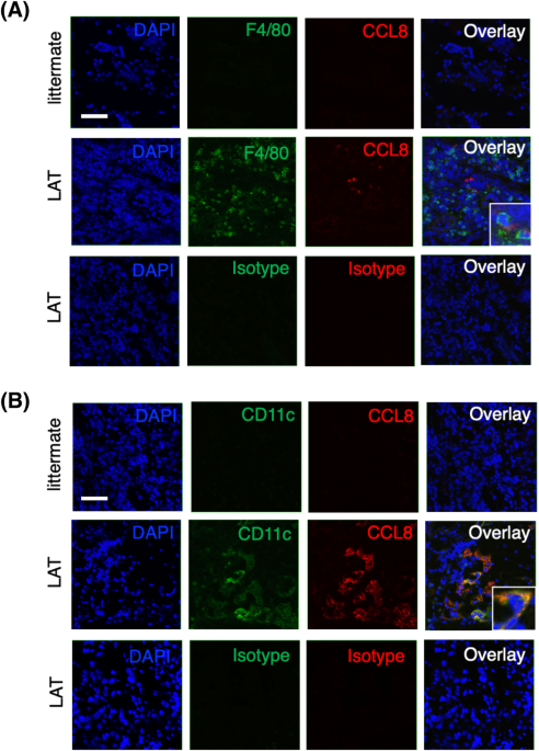 Pathogenic roles and therapeutic potential of the cclâccr axis in a murine model of igg