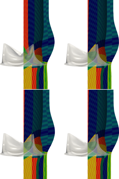 Heart valve isogeometric sequentially