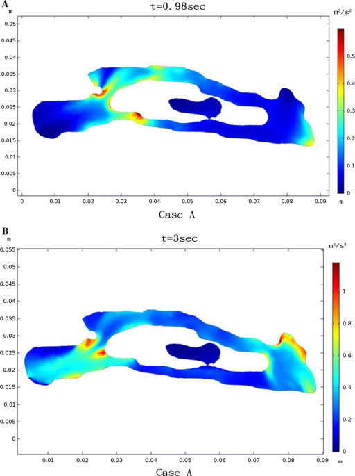 Putation and analysis for airflow characteristics of physical quantities caused by nasal obstruction microsystem technologies