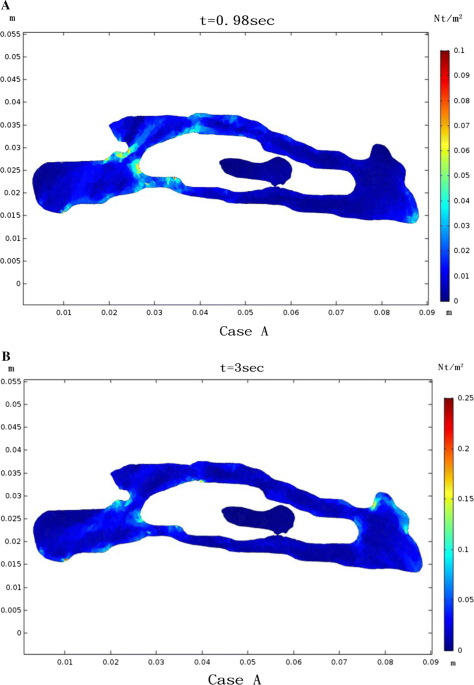 Putation and analysis for airflow characteristics of physical quantities caused by nasal obstruction microsystem technologies