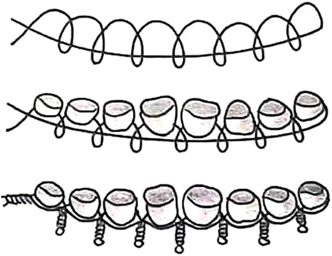 Management of specific fractures in large animals