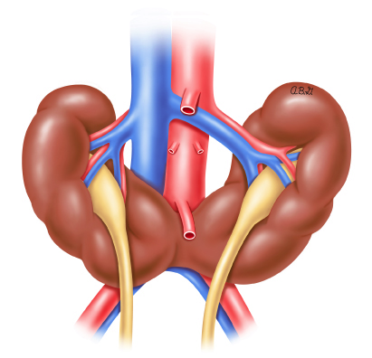 Wall segments coronary artery dis flashcards