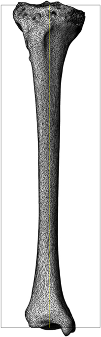 Preliminary exploration of a quantitative assessment index for the matching performance of anatomical bone plates using puter journal of orthopaedic surgery and research full text