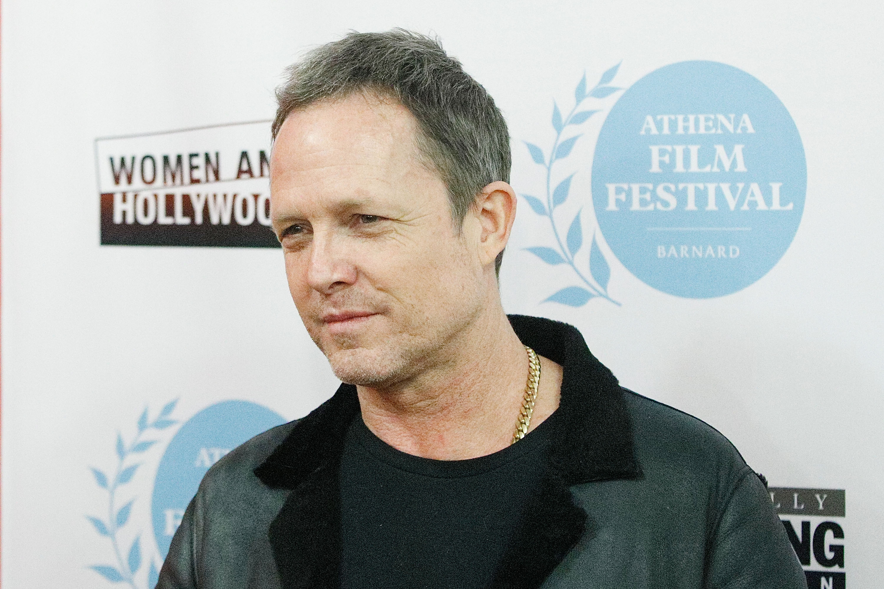 Why allstates mayhem actor dean winters had multiple amputations