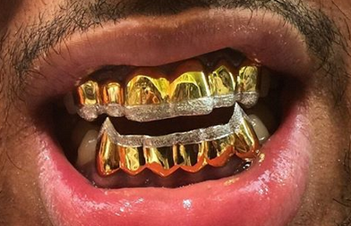 Download Free 100 + gold teeth Wallpapers