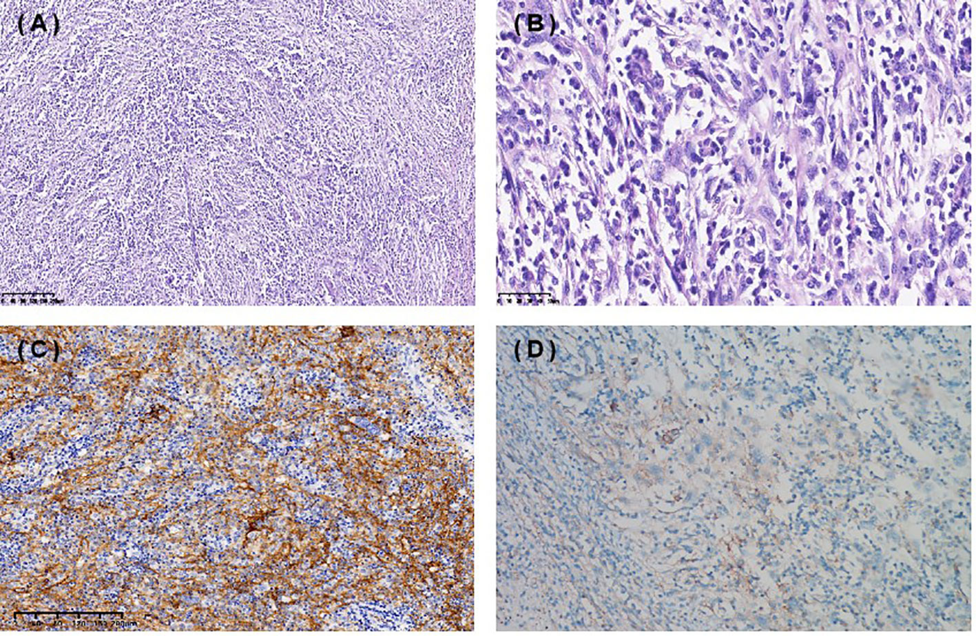 Frontiers favorable response to pd