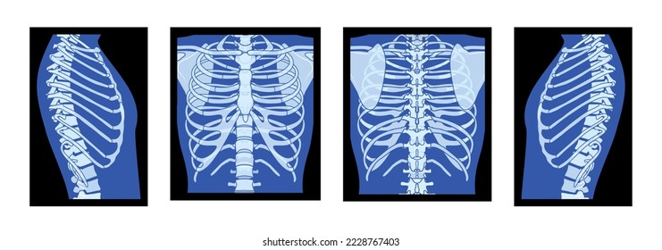 Rib cage images stock photos d objects vectors