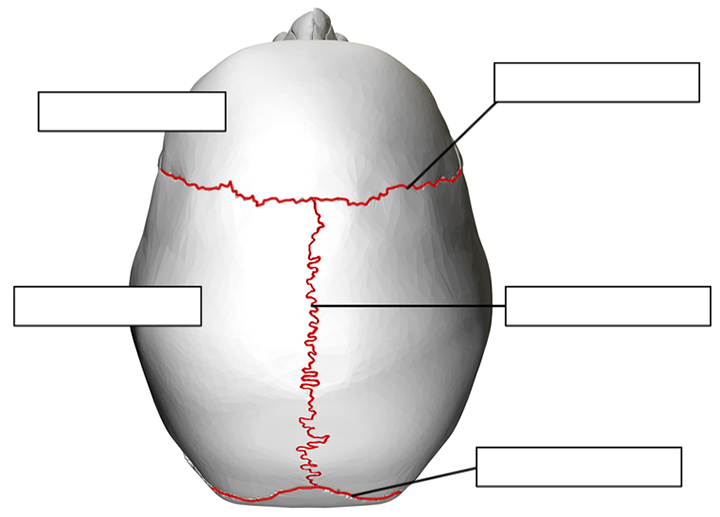 Label the bones of the skull