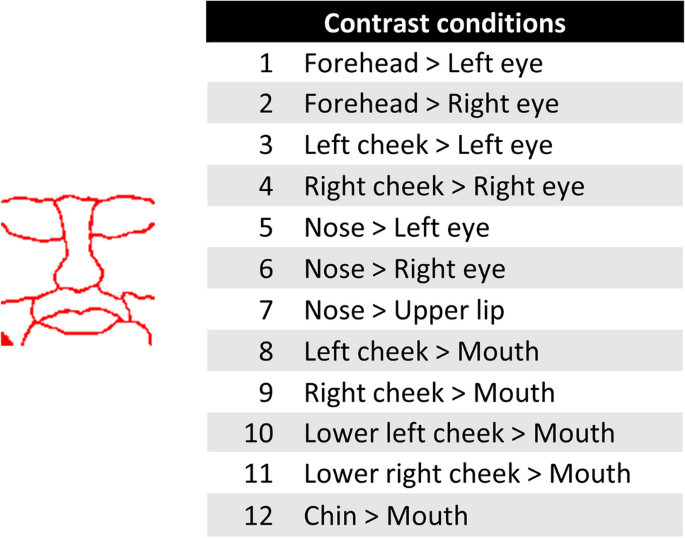 The importance of contrast features in rat vision scientific reports