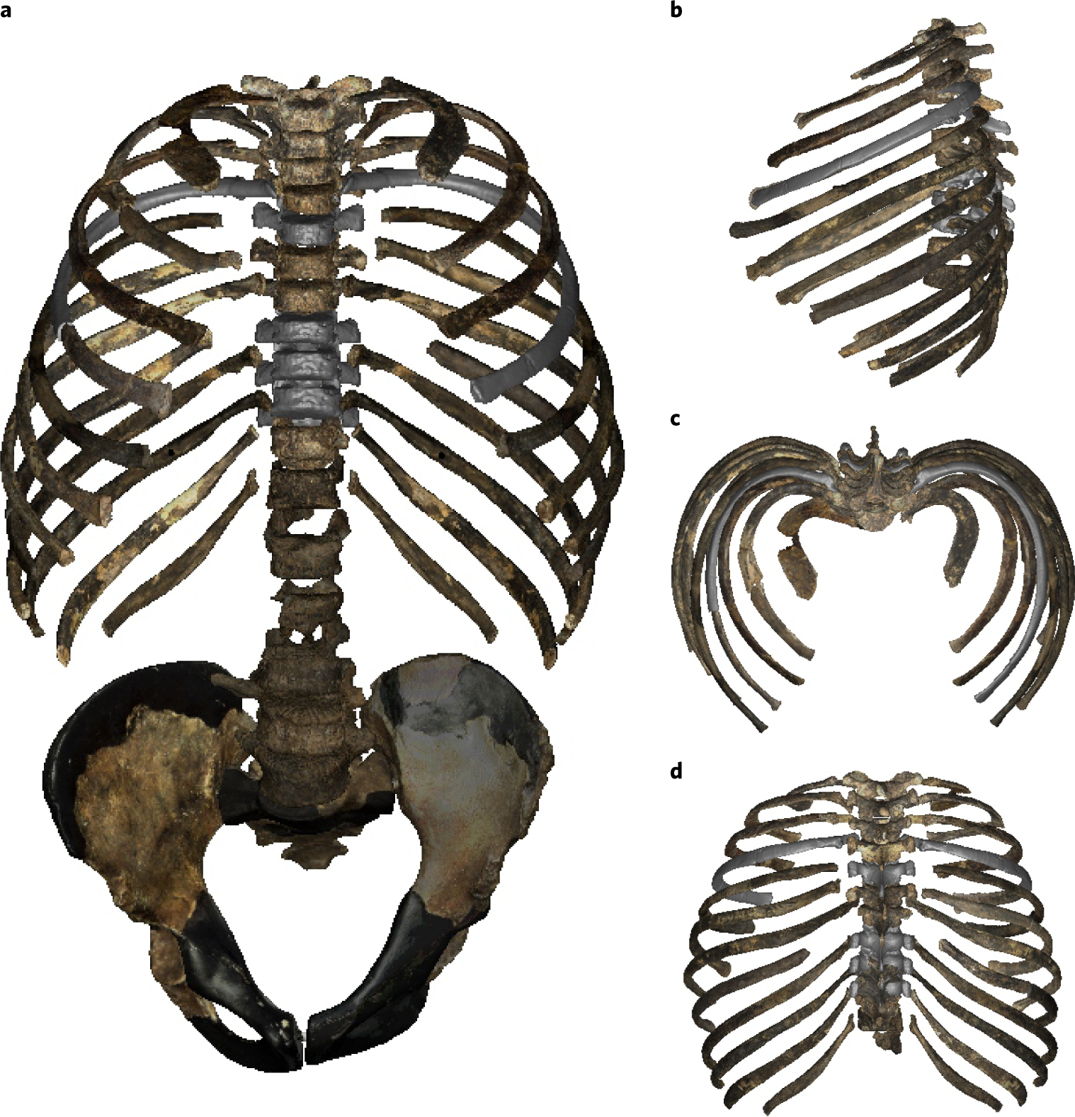 Rib cage anatomy in homo erectus suggests a recent evolutionary origin of modern human body shape ecology evolution