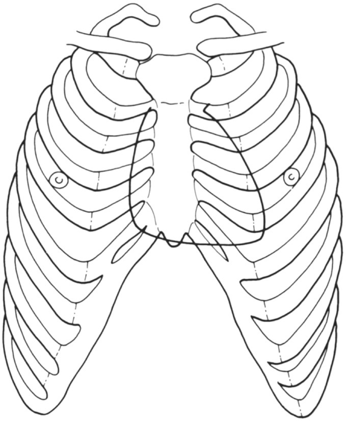 The thorax basicmedical key