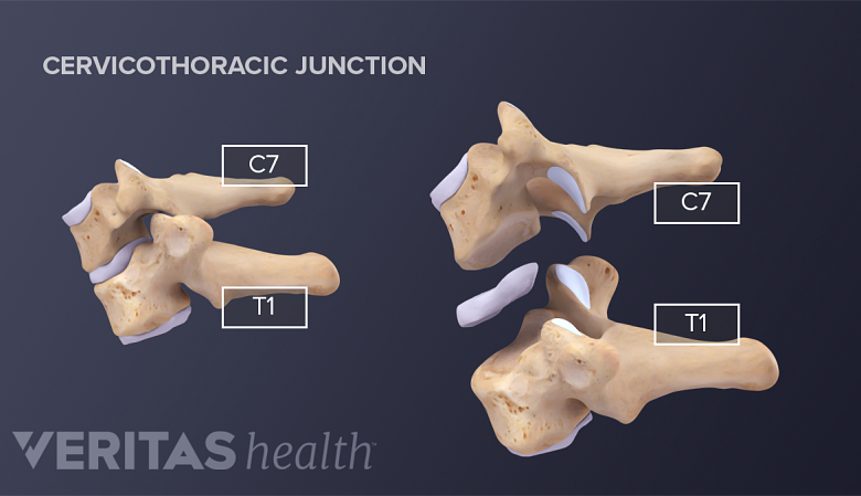 Thoracic vertebrae and the rib cage spine