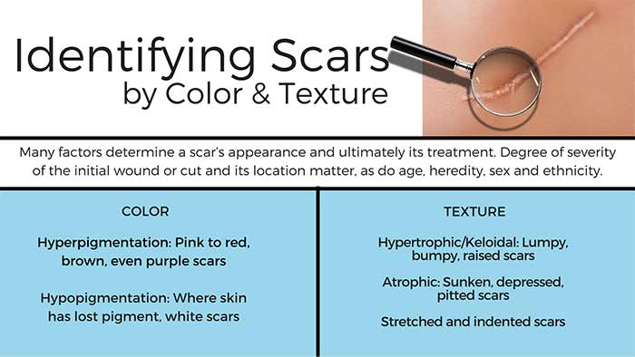 Scar solutions minimizing the appearance of scars