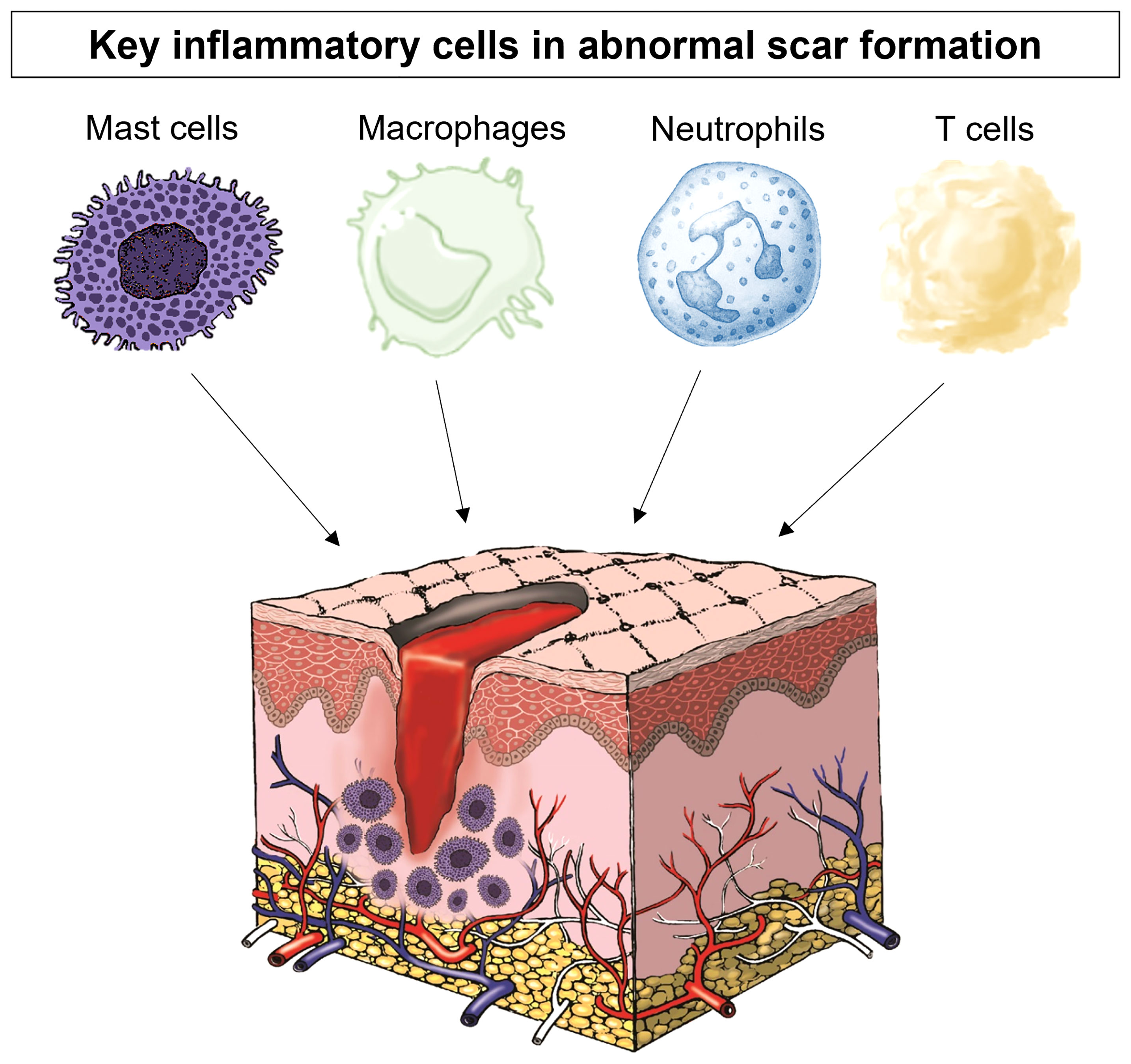 Frontiers controlling inflammation pre