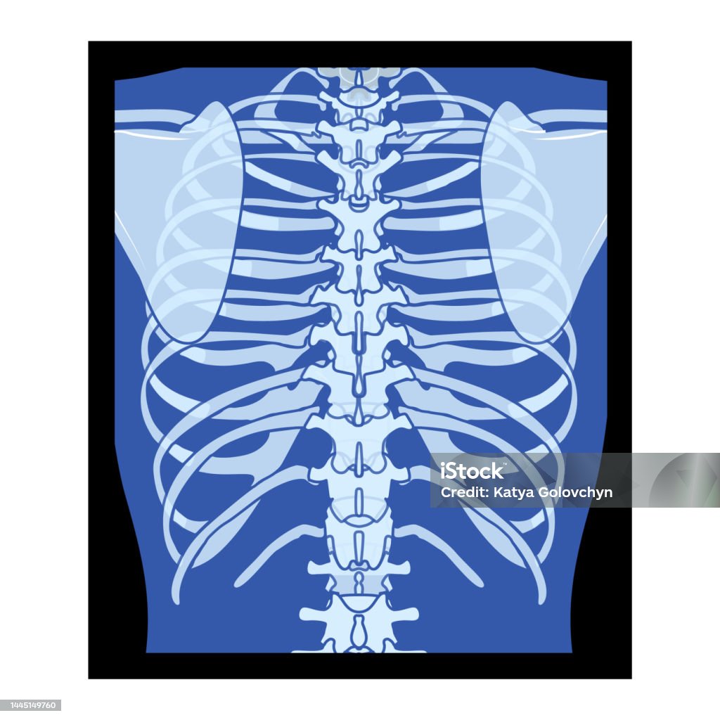 Xray rib cage skeleton human body chest vertebra bones adult people roentgen back view d realistic flat blue color concept vector illustration of medical anatomy isolated on black background stock illustration