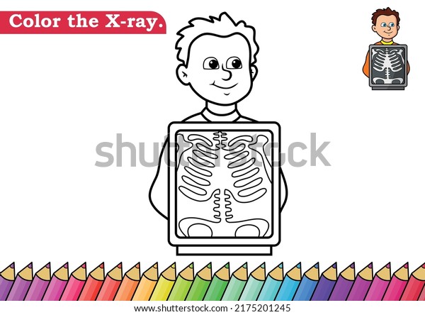 X ray drawing over royalty