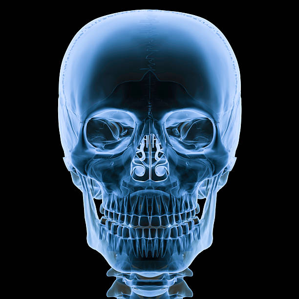 Skull xray stock photos pictures royalty