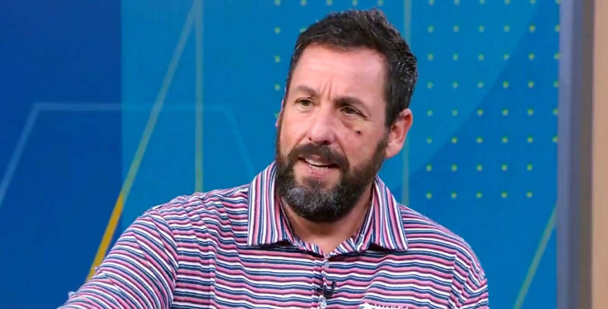 adam Sandler Explains Black Eye On Good Morning America Peoplecom