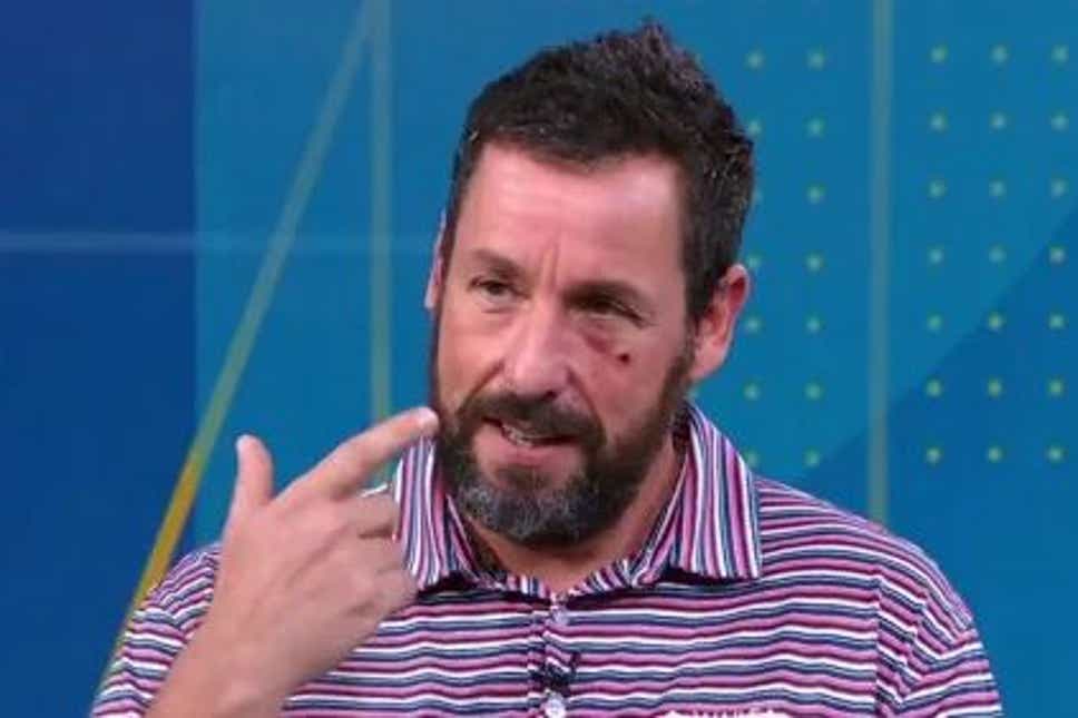 adam Sandler Reveals He Got A Black Eye After Accident With Mobile Phone  Evening Standard